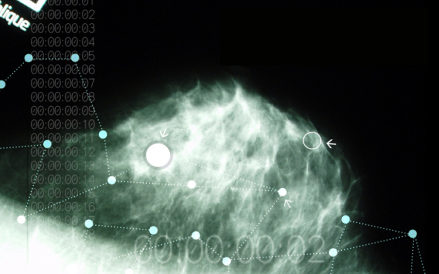 realtime results points numbers xray breast cancer medical results visuals 